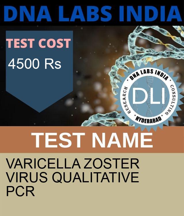 Varicella Zoster Virus Qualitative PCR