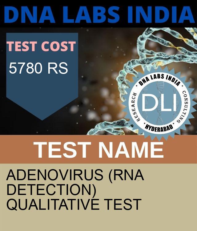 Adenovirus (RNA Detection) Qualitative Test