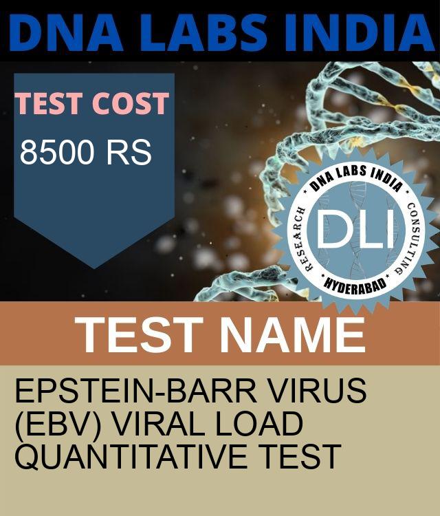 Epstein-Barr virus (EBV) Viral Load Quantitative Test