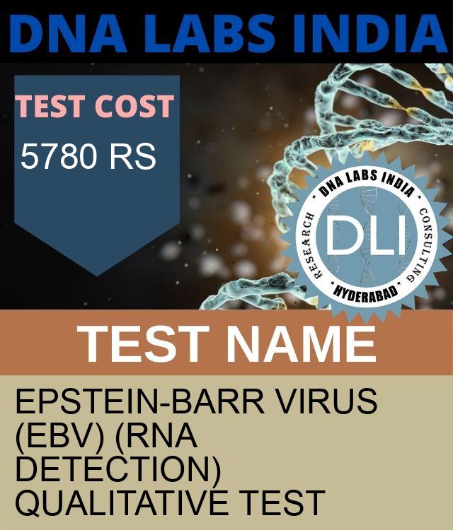 Epstein-Barr virus (EBV) (RNA Detection) Qualitative Test