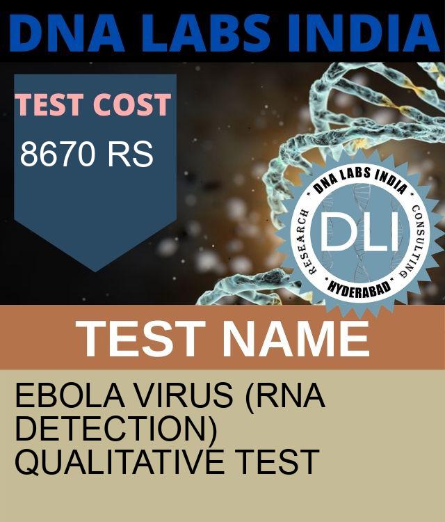Ebola Virus (RNA Detection) Qualitative Test