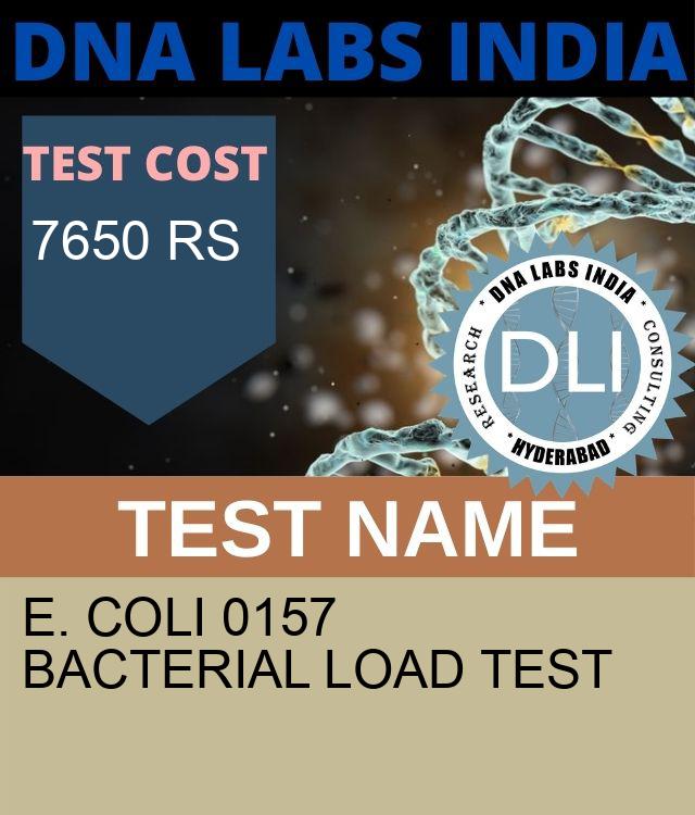 E. Coli 0157 Bacterial Load Test