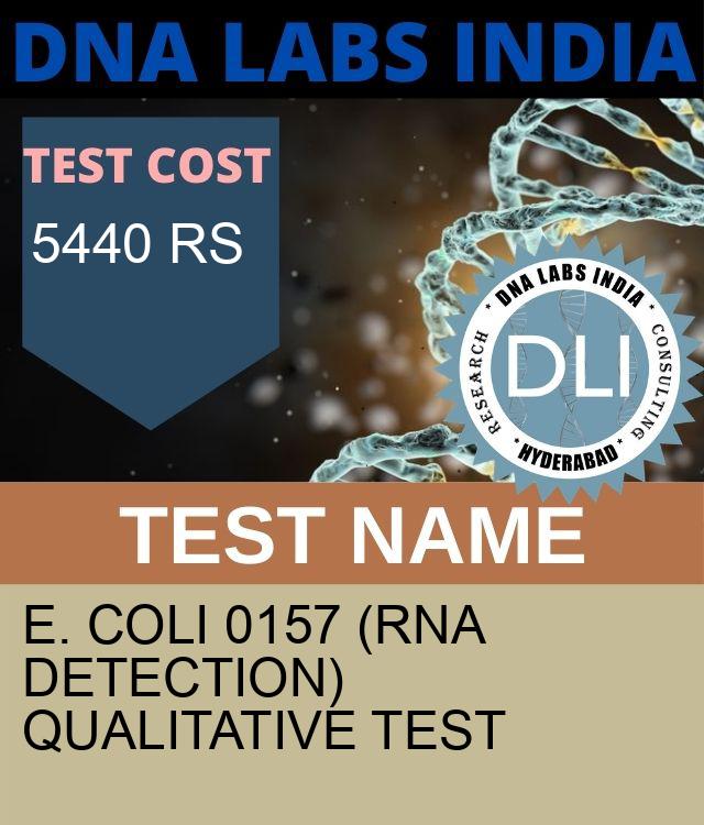 E. Coli 0157 (RNA Detection) Qualitative Test