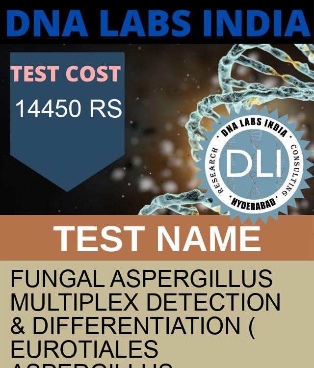 Fungal Aspergillus Multiplex Detection & Differentiation ( Eurotiales Aspergillus. Aspergillus NIGER, Aspergillus FUMIGATUS, Aspergillus FLAVUS & ORZAE, Aspergillus NIDULANS, Aspergillus TERRUS) (RNA Detection) Qualitative Test