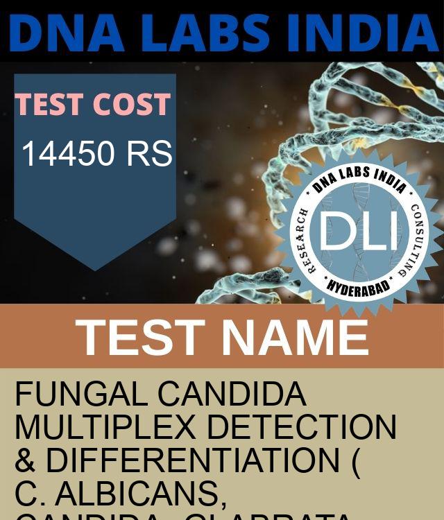 Fungal Candida multiplex Detection & Differentiation ( C. albicans, Candida. glabrata, C. tropicalis, C. parapsilosis, C. krusei, Candida nivariensis, Candida dubliniensis, Candida Clavispora lusitaniae) (RNA Detection) Qualitative Test