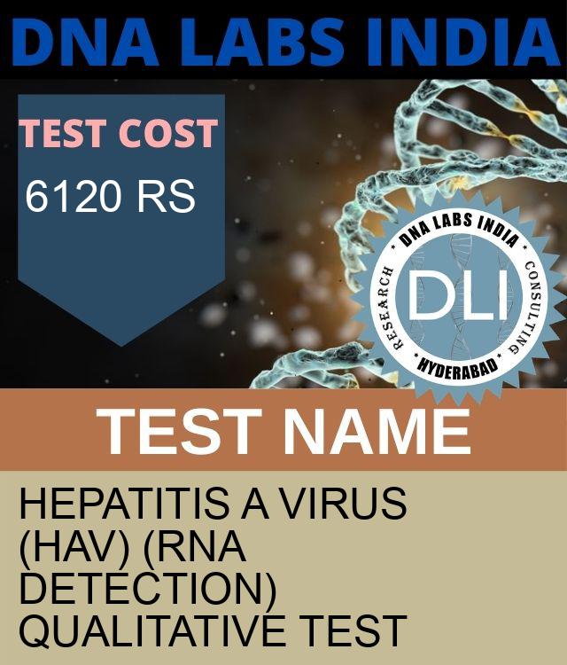 Hepatitis A Virus (HAV) (RNA Detection) Qualitative Test