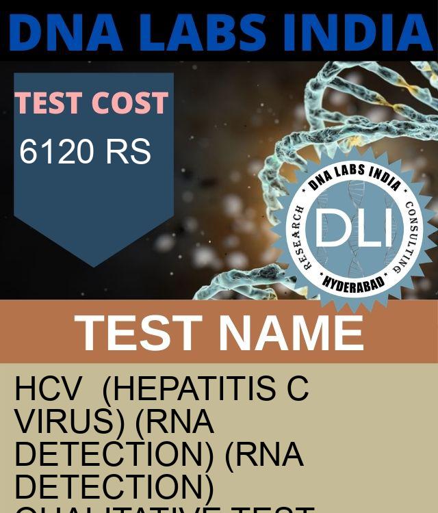 HCV  (Hepatitis C Virus) (RNA Detection) (RNA Detection) Qualitative Test
