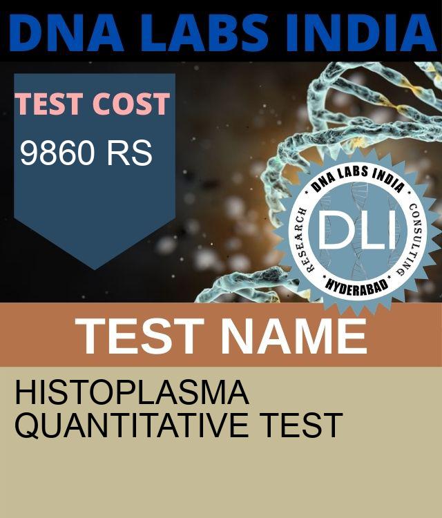 Histoplasma Quantitative Test