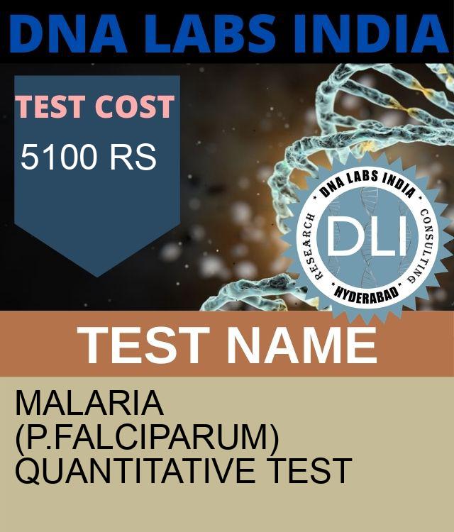 Malaria (P.Falciparum) Quantitative Test