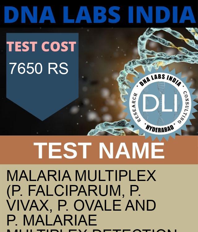 Malaria Multiplex (P. Falciparum, P. Vivax, P. Ovale and P. Malariae Multiplex Detection & Differentiation (RNA Detection) Qualitative Test