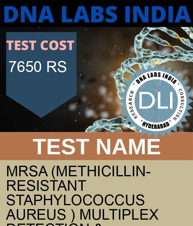 MRSA (Methicillin-resistant Staphylococcus aureus ) Multiplex detection & Differentiation (DNA Detection) Qualitative Test