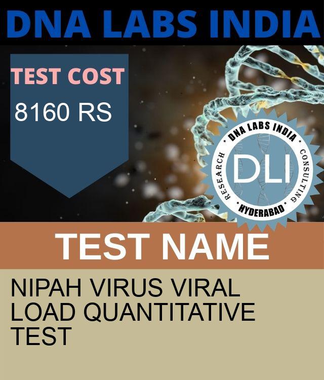 Nipah Virus Viral Load Quantitative Test
