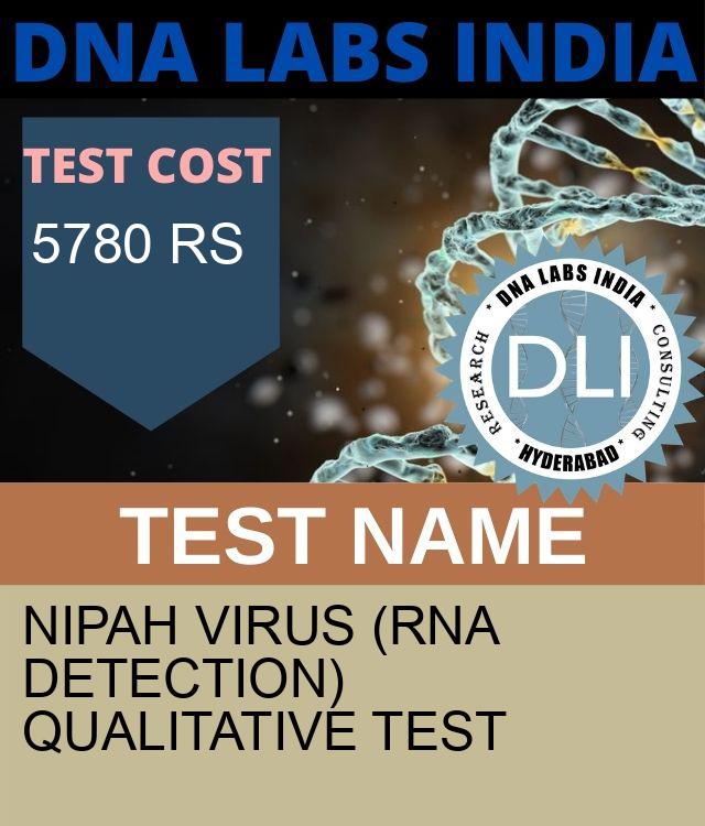 Nipah Virus (RNA Detection) Qualitative Test