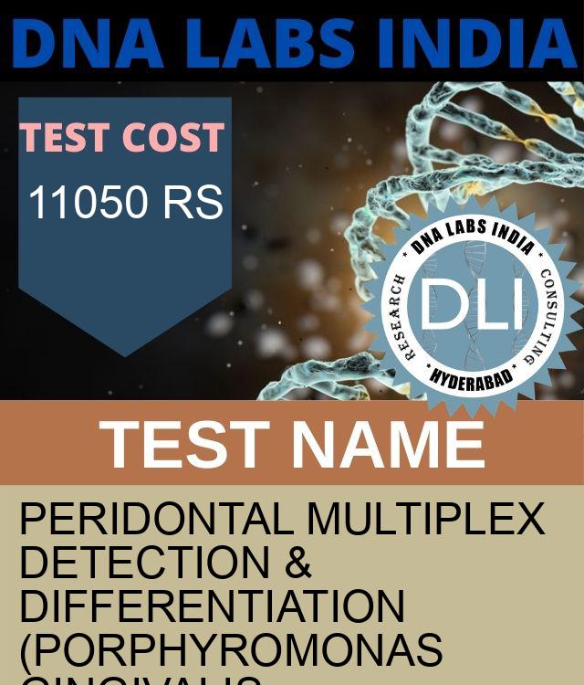 Peridontal Multiplex Detection & Differentiation (Porphyromonas gingivalis, Treponema denticola, tannerella forsythia & Fusobacterium nucleatum) (RNA Detection) Qualitative Test