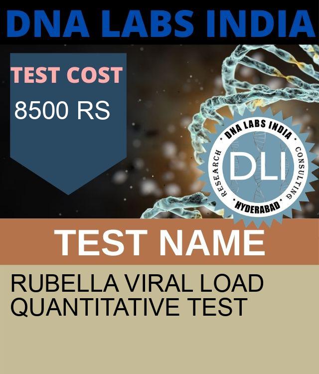 RUBELLA Viral Load Quantitative Test