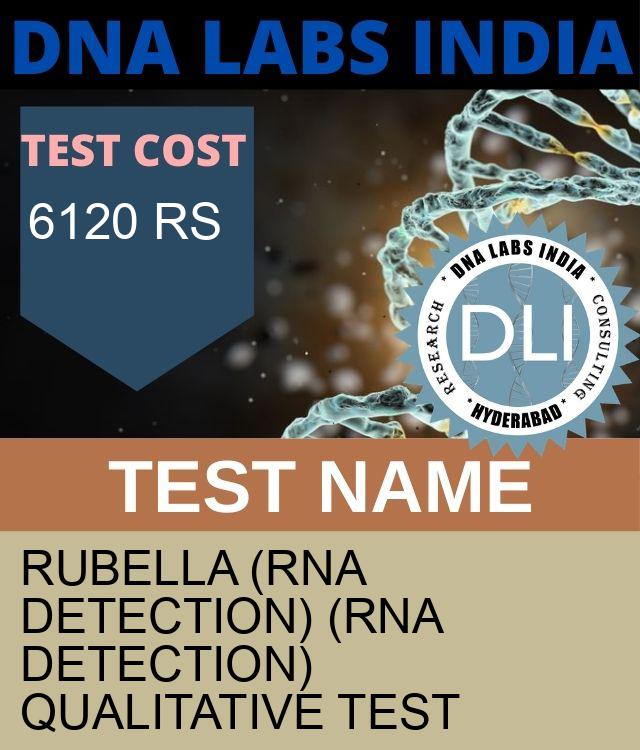 RUBELLA (RNA detection) (RNA Detection) Qualitative Test