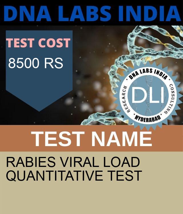 RABIES Viral Load Quantitative Test