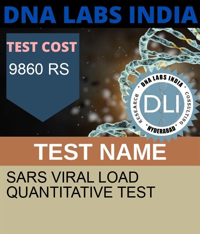 SARS Viral Load Quantitative Test