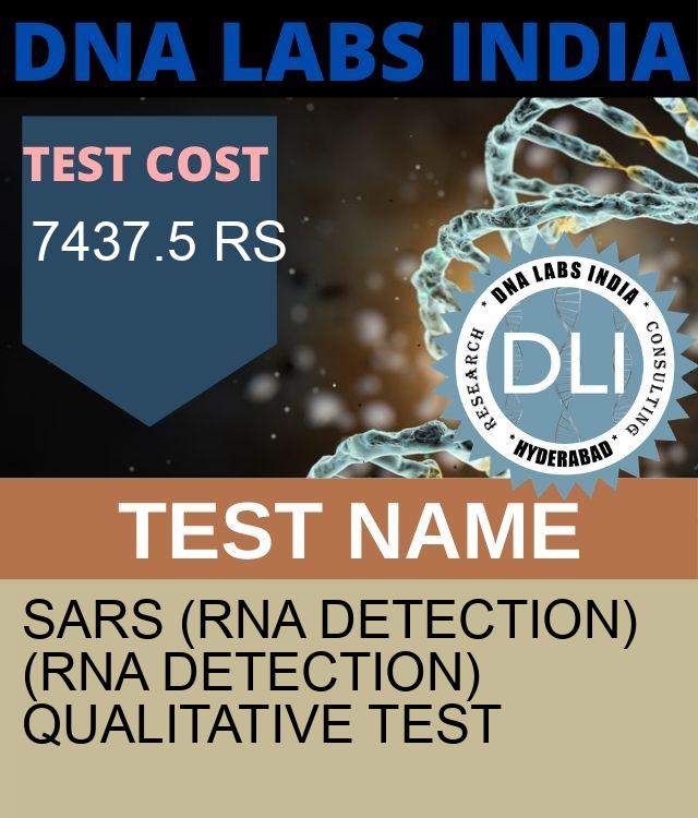 SARS (RNA detection) (RNA Detection) Qualitative Test