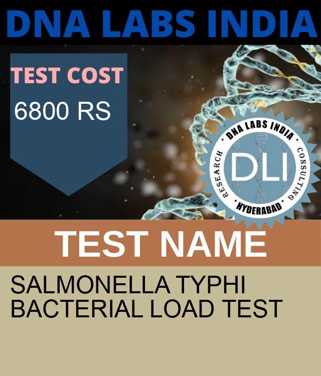 Salmonella Typhi Bacterial Load Test