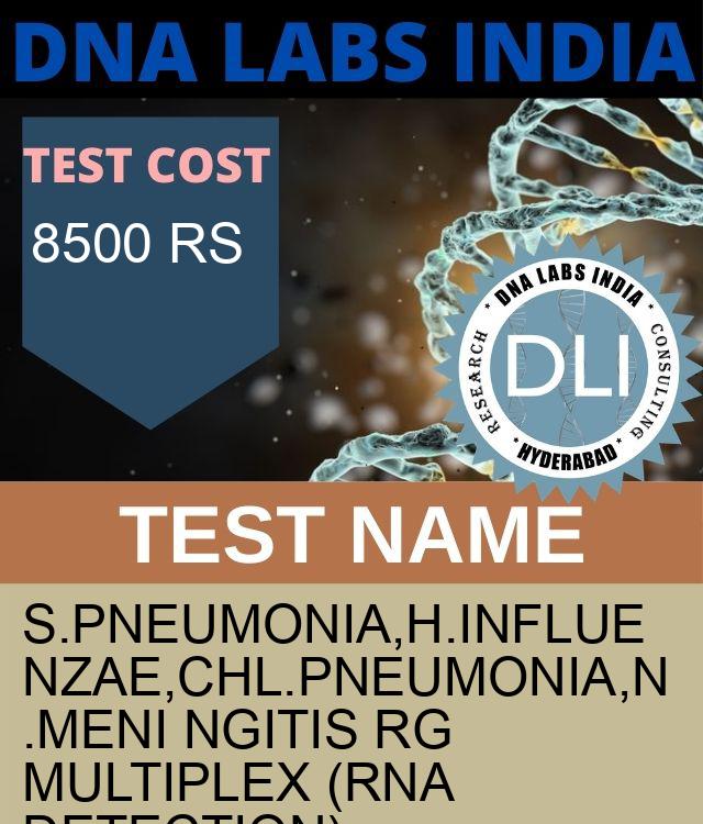 S.PNEUMONIA,H.INFLUENZAE,CHL.PNEUMONIA,N.MENI NGITIS RG MULTIPLEX (RNA Detection) Qualitative Test