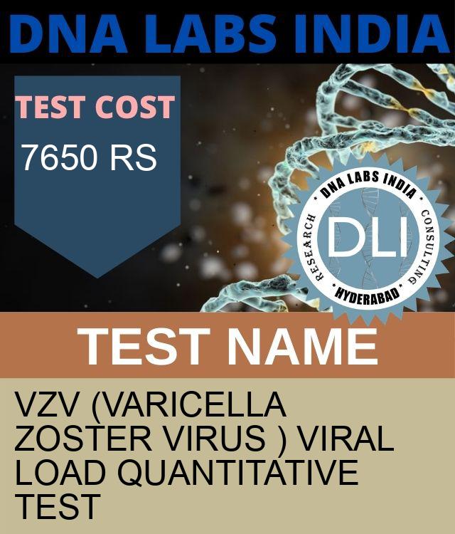 VZV (Varicella Zoster Virus ) Viral Load Quantitative Test