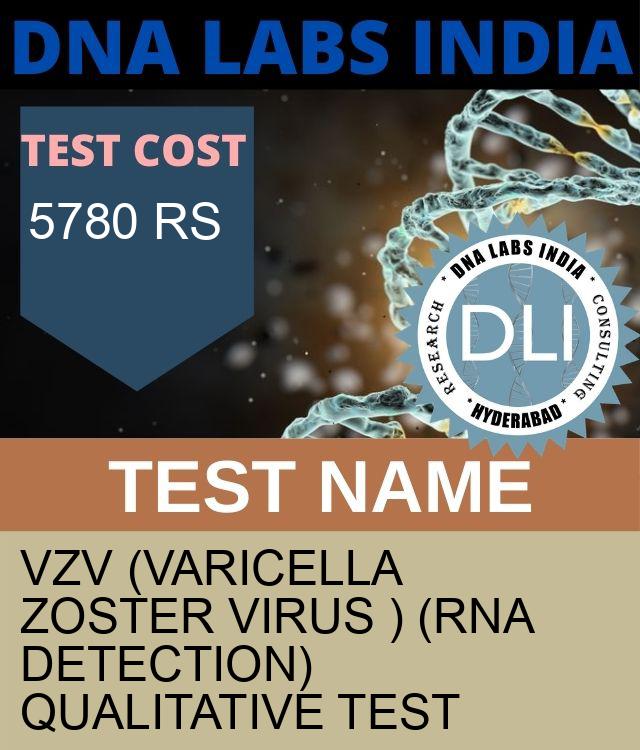 VZV (Varicella Zoster Virus ) (RNA Detection) Qualitative Test