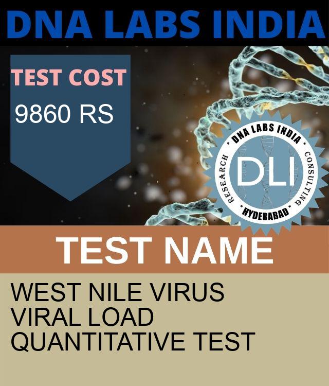 West Nile Virus Viral Load Quantitative Test