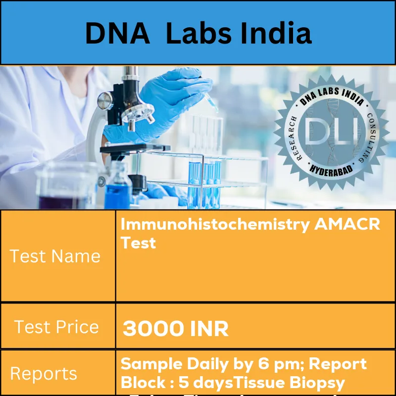 Immunohistochemistry AMACR Test cost Submit tumor tissue in 10% Formal-saline OR Formalin fixed paraffin embedded block. Ship at room temperature. Provide a copy of the Histopathology report