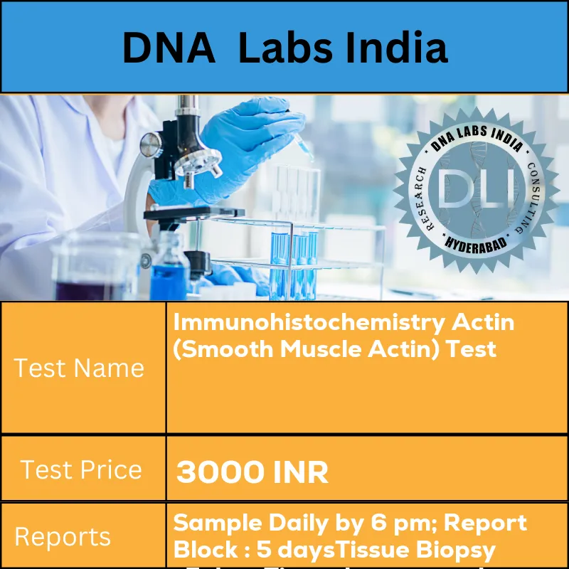 Immunohistochemistry Actin (Smooth Muscle Actin) Test cost Submit tumor tissue in 10% Formal-saline OR Formalin fixed paraffin embedded block. Ship at room temperature. Provide a copy of the Histopathology report