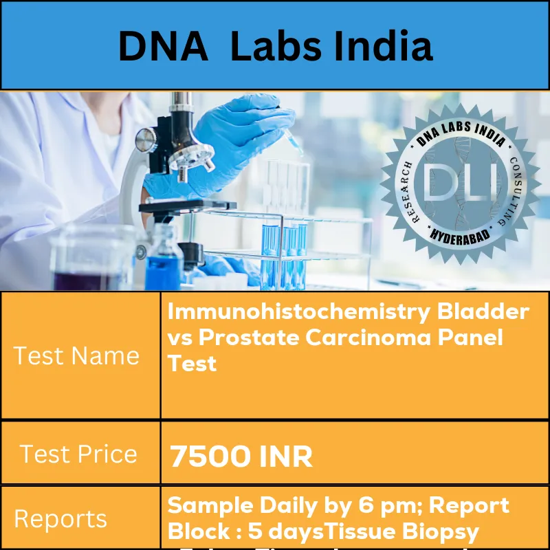 Immunohistochemistry Bladder vs Prostate Carcinoma Panel Test cost Submit tumor tissue in 10% Formal-saline OR Formalin fixed paraffin embedded block. Ship at room temperature. Provide a copy of the Histopathology report