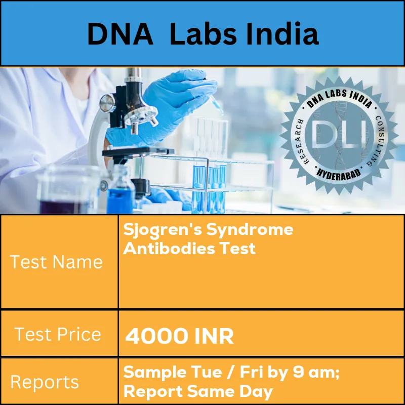 Sjogren's Syndrome Antibodies Test cost 2 mL (1 mL min.) serum from 1 SST. Ship refrigerated or frozen. INR in India