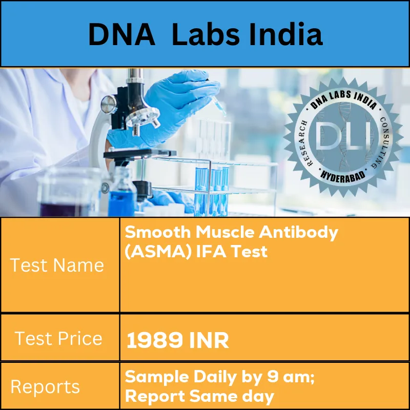 Smooth Muscle Antibody (ASMA) IFA Test cost 2 mL (1 mL min.) serum from 1 SST. Ship refrigerated or frozen. Overnight fasting is preferred. INR in India