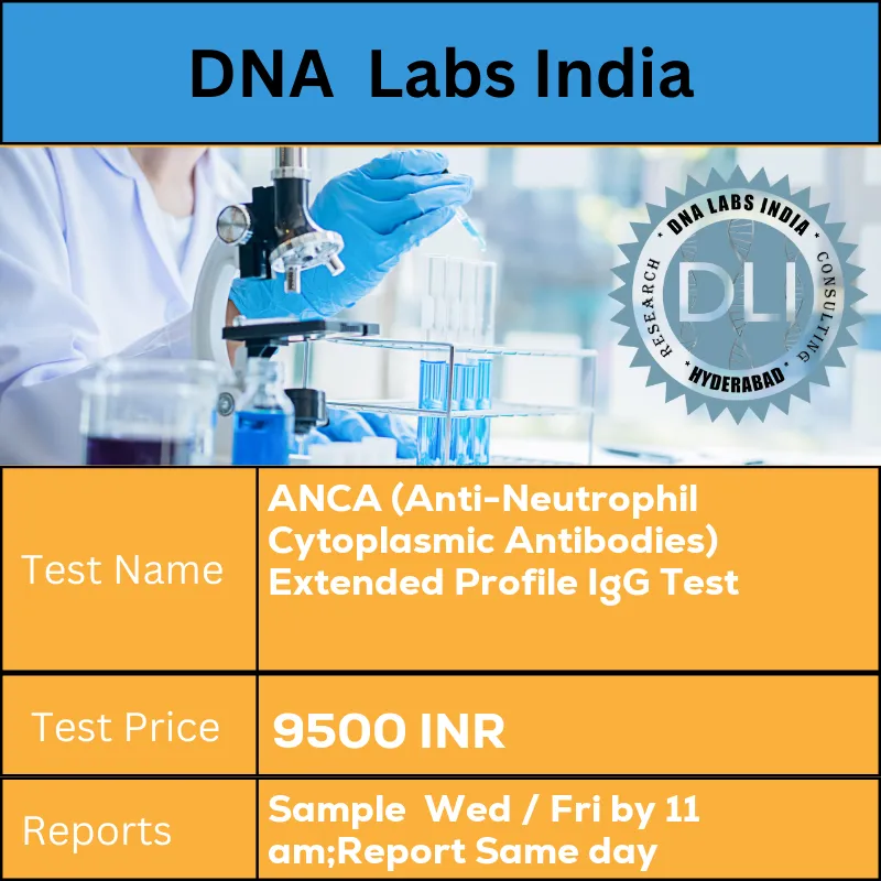 ANCA (Anti-Neutrophil Cytoplasmic Antibodies) Extended Profile IgG Test cost 2 mL (1 mL min.) serum from 1 SST. Ship refrigerated or frozen. INR in India