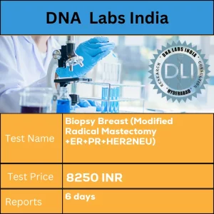 Biopsy Breast (Modified Radical Mastectomy +ER+PR+HER2NEU) cost Tissue INR in India