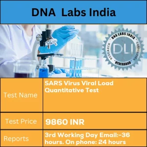 SARS Virus Viral Load Quantitative Test cost Bronchial Swabs